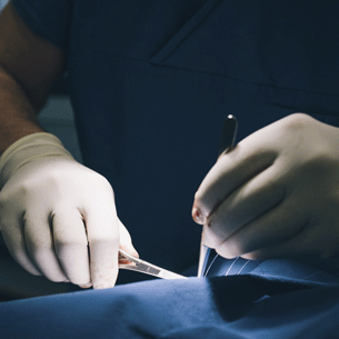 Intensive care and cardiac surgery